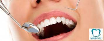 clinica dental en malaga alejandro alonso sierra